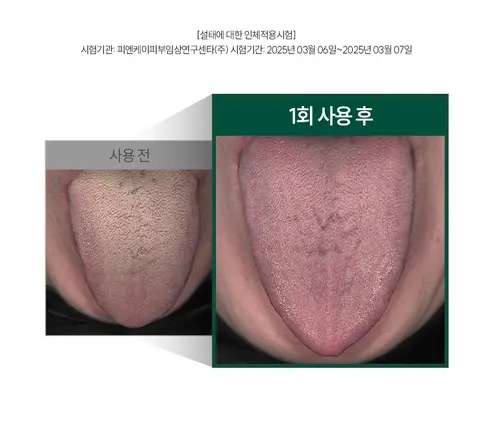 지그비 고불소 구취케어 치약, 아쿠아민트향, 117g, 4개 상세 이미지 12