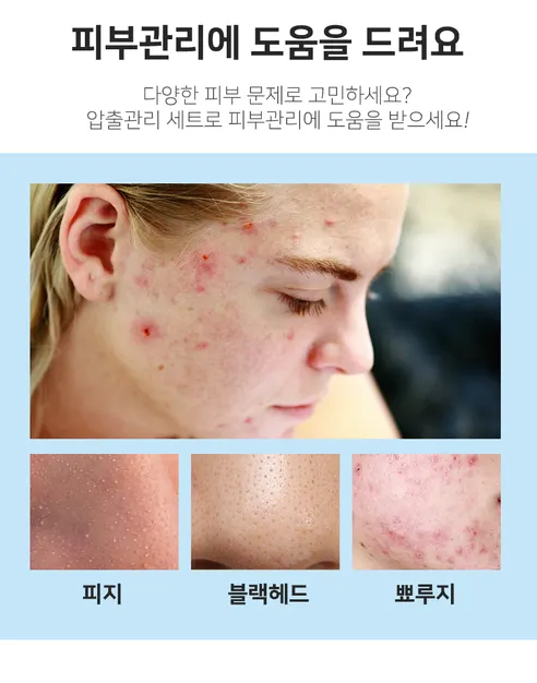 여드름압출기8종세트, 플라스틱 케이스, 1세트 상세 이미지 10