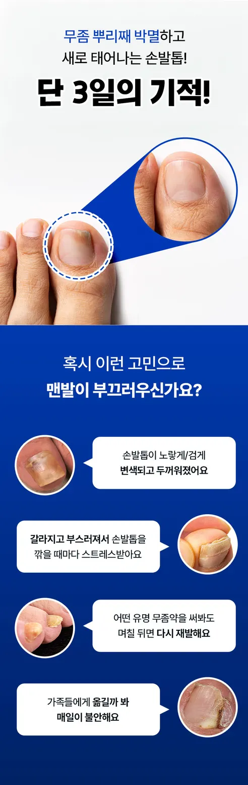 미라클 치료제, 30ml, 2개 상세 이미지 4