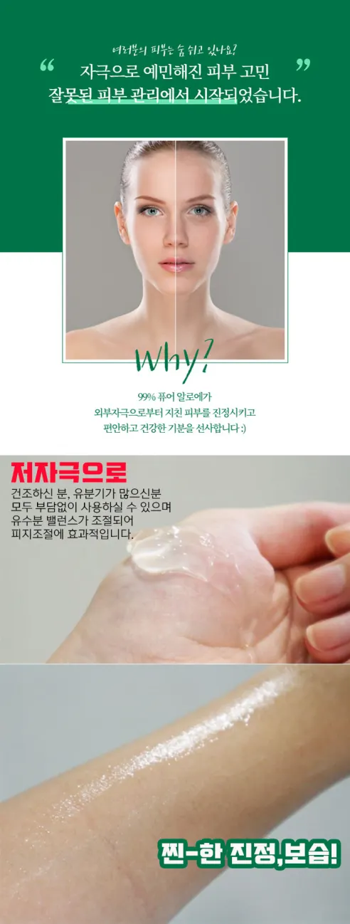 앙쥬 알로에 수딩젤, 300ml, 1+1+1+1+1 구성, 총 5개 상세 이미지 5
