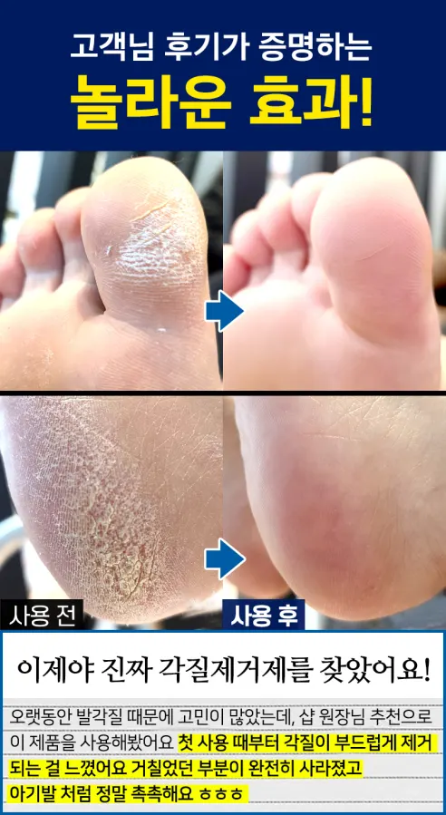 풋시톨 발각질 제거제 + 풋파일 1개 상세 이미지 8