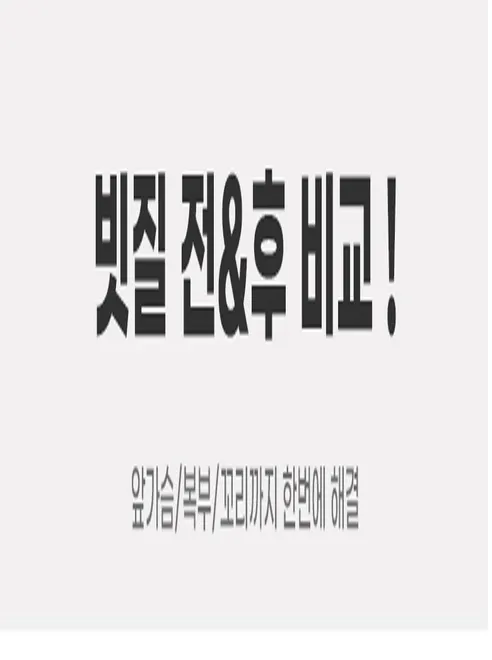 피부 무손상 모찌빗, 핑크, 1개 상세 이미지 3