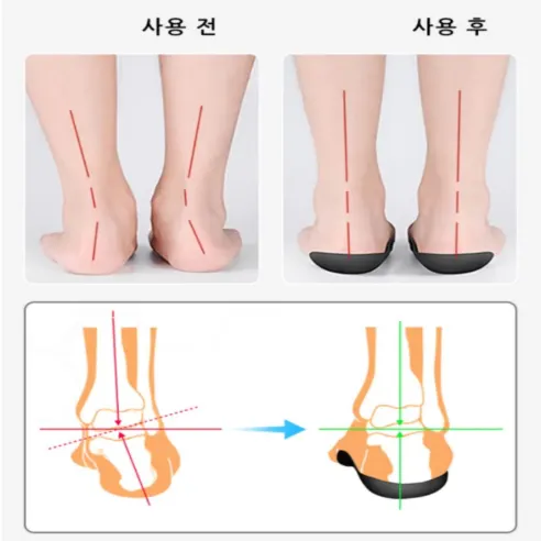 족저근 바른 아치 깔창, 225-240, 2세트 상세 이미지 11