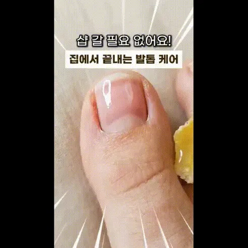 미라클 치료제, 30ml, 2개 상세 이미지 2