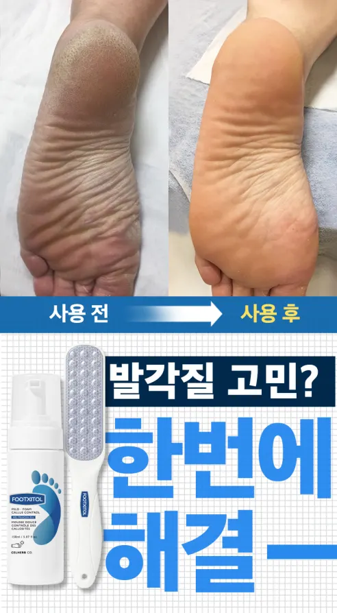 풋시톨 발각질 제거제 + 풋파일 1개 상세 이미지 4
