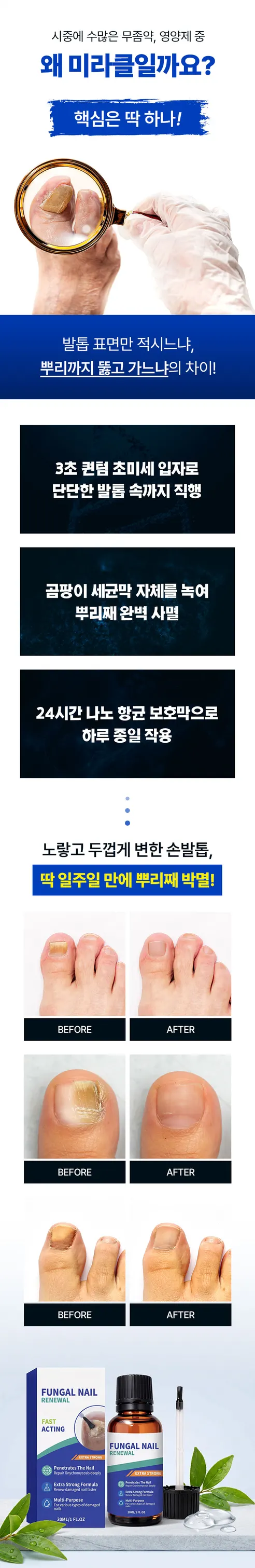 미라클 치료제, 30ml, 2개 상세 이미지 7