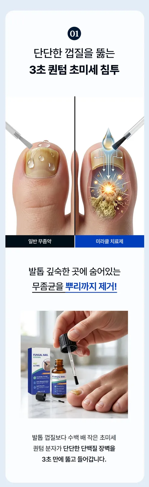 미라클 치료제, 30ml, 2개 상세 이미지 8