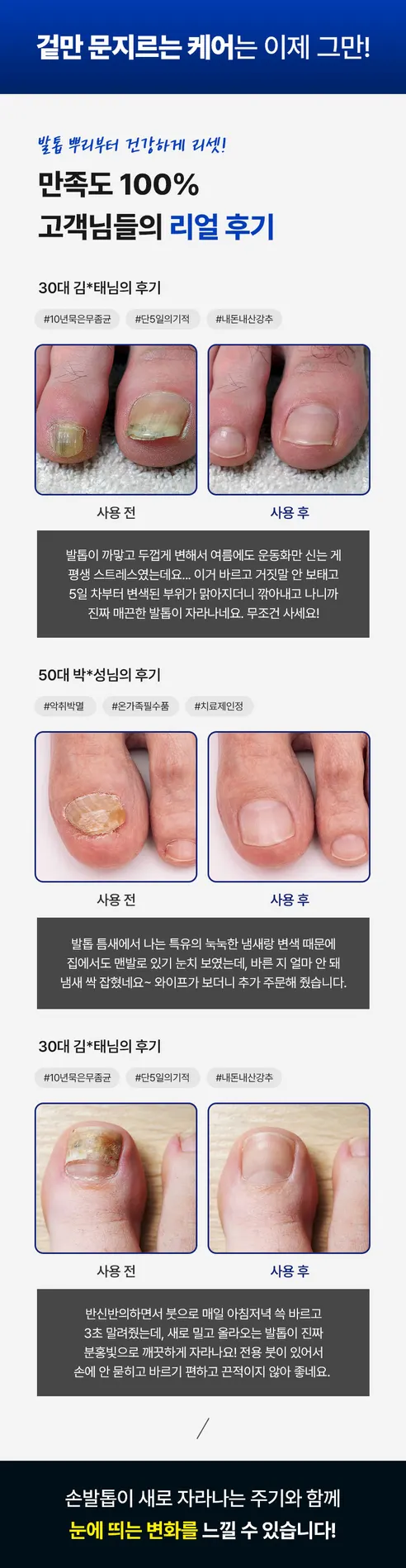 미라클 치료제, 30ml, 2개 상세 이미지 6