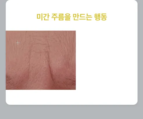 뷰티영 DNA 미간 주름 패치, 30매, 1개 상세 이미지 7