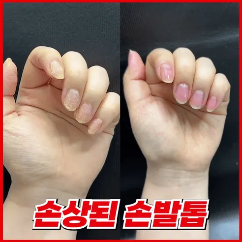 셀허브 핑크네일 리뉴, 15ml, 4개 상세 이미지 1