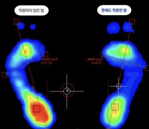 일감생활 풋 아치 패드, 블랙, S, 1쌍 상세 이미지 15