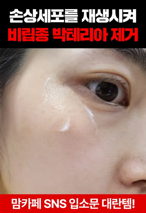 비타리얼 기미 스팟크림, 15ml, 2개 상세 이미지 6