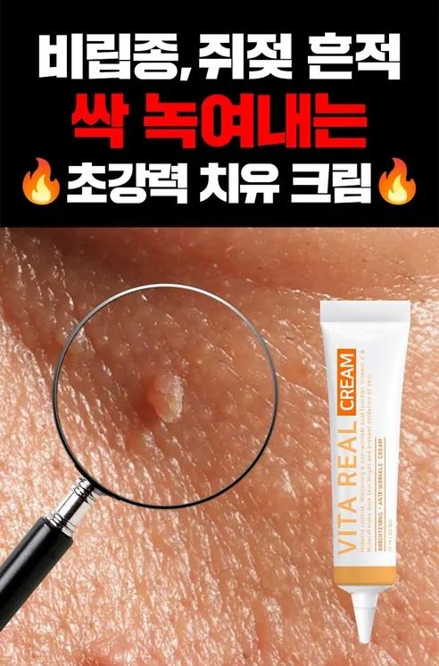 비타리얼 기미 스팟크림, 15ml, 2개 상세 이미지 3