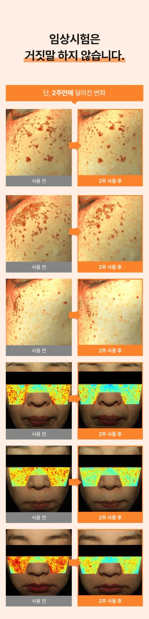 비시나 기미크림, 50ml, 1개 상세 이미지 7
