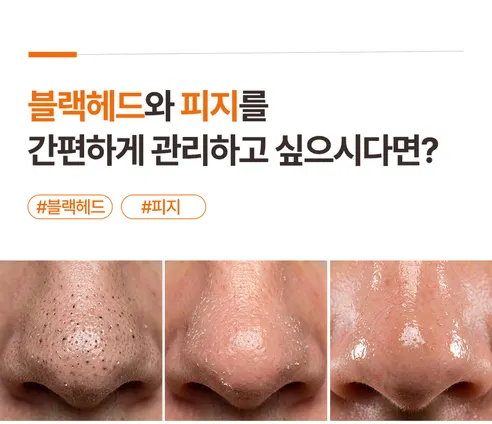 화산송이 클레이 블랙헤드 마스크, 120g, 2개 상세 이미지 2