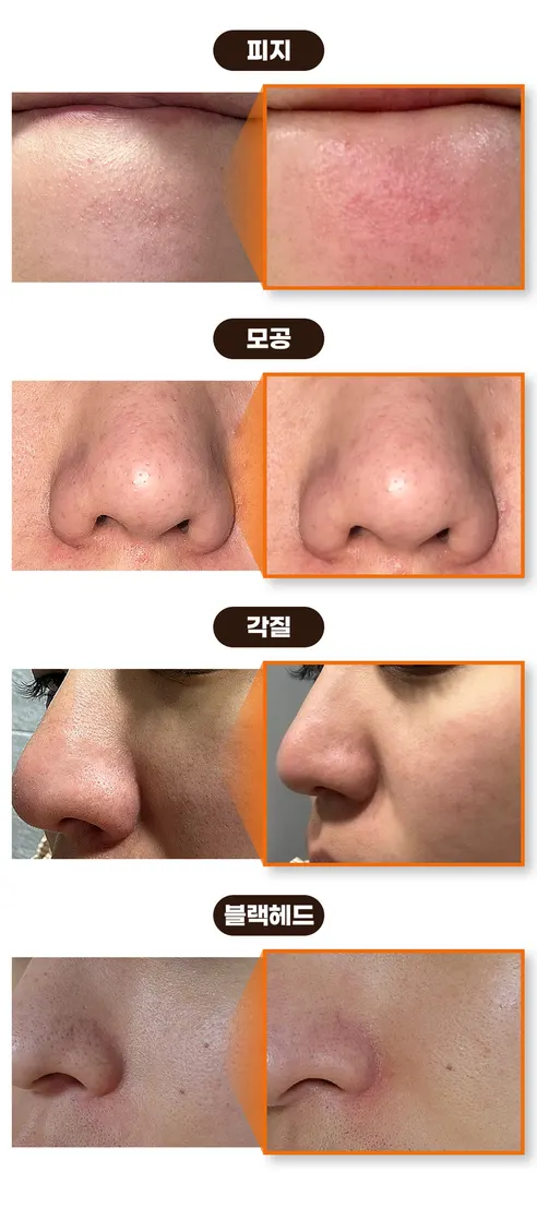 화산송이 클레이 블랙헤드 마스크, 120g, 2개 상세 이미지 8