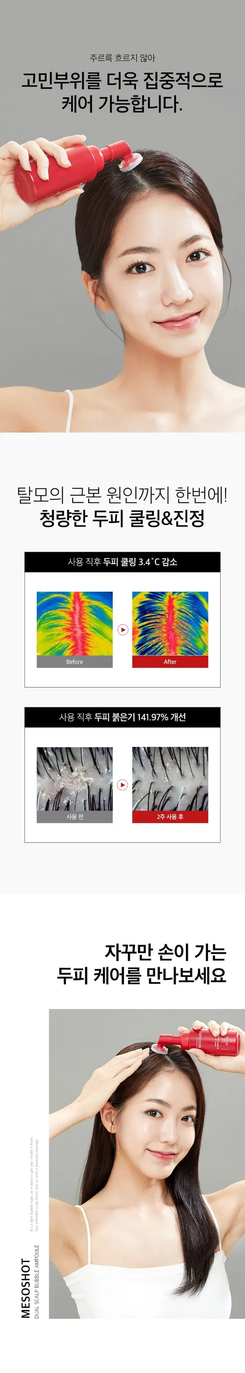 뷰티영 메조샷 두피 앰플, 60ml, 1개 상세 이미지 26