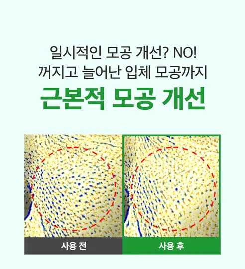 성분에디터 그린토마토 엔앰엔 포어 리프팅 앰플, 75ml, 2개 상세 이미지 3